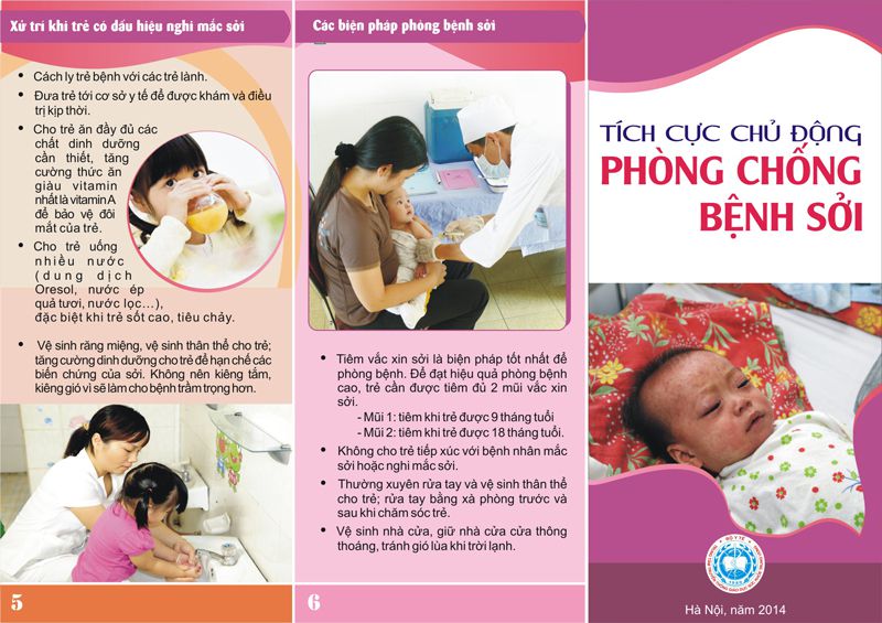 Tờ rơi phòng chống dịch bệnh sởi